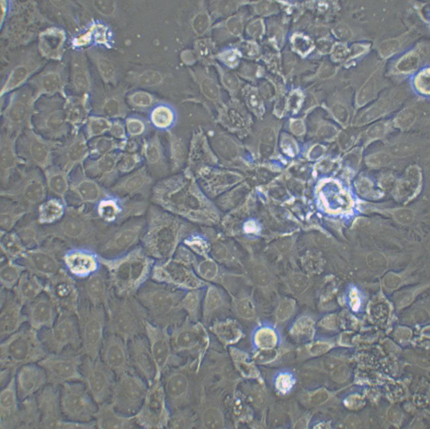 NCI-H508 Cell:人结肠直肠腺癌细胞系,NCI-H508 Cell