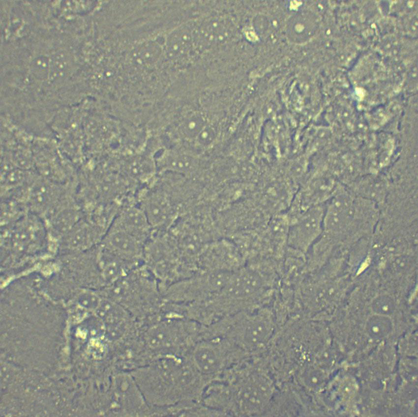 SW620 Cell:人結(jié)腸癌細(xì)胞系,SW620 Cell