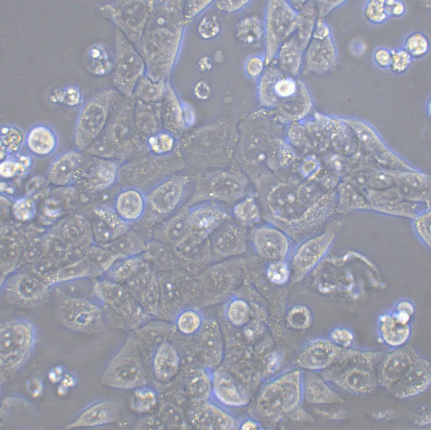 GBC-SD Cell:人膽囊癌細胞系,GBC-SD Cell