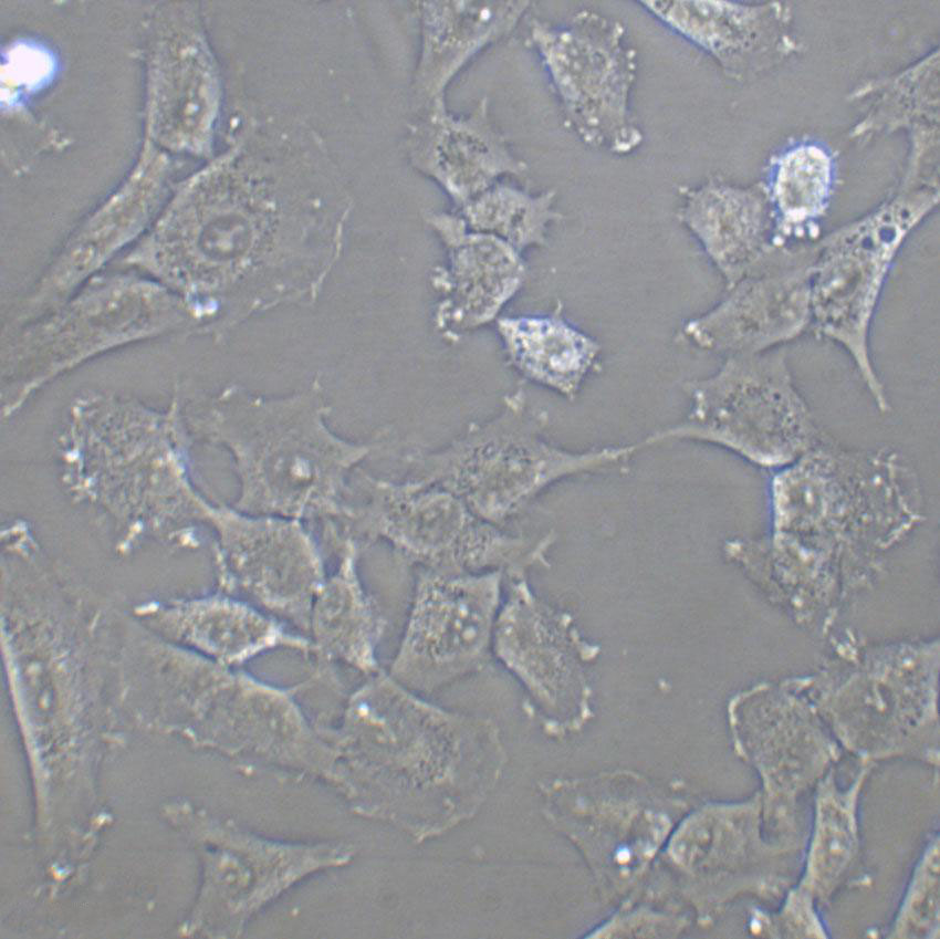 HCCC-9810 Cell:人胆管细胞型肝癌细胞系,HCCC-9810 Cell