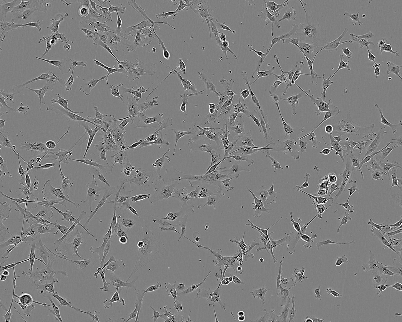 PLA-801D Cell:人高轉(zhuǎn)移肺癌細(xì)胞系,PLA-801D Cell