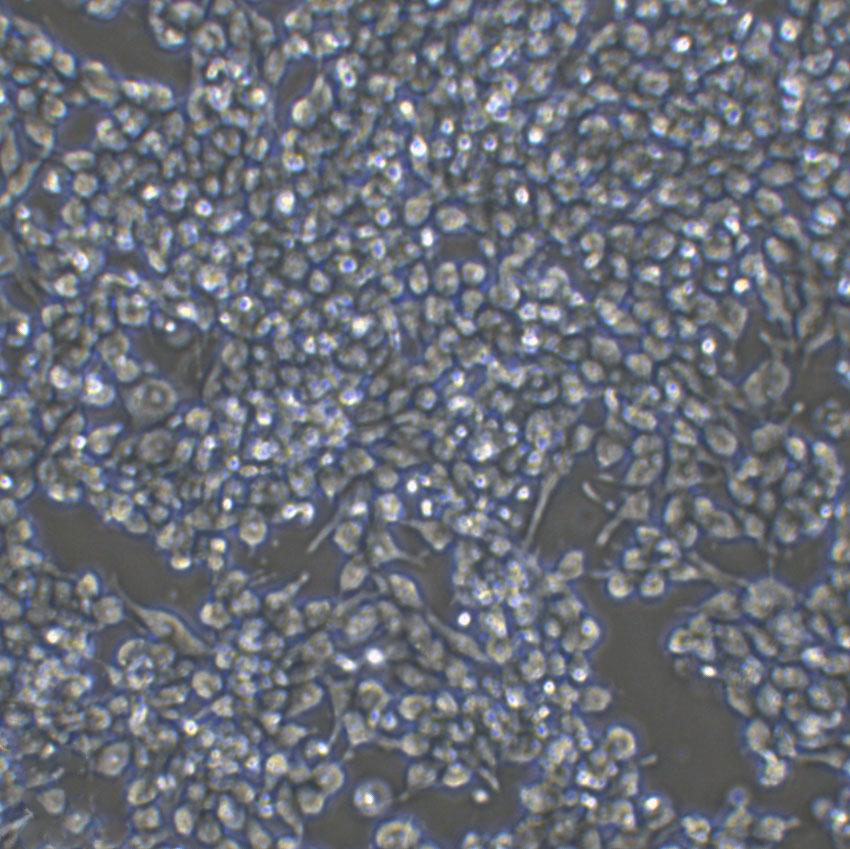 NCI-H226 Cell:人肺鳞癌细胞系,NCI-H226 Cell