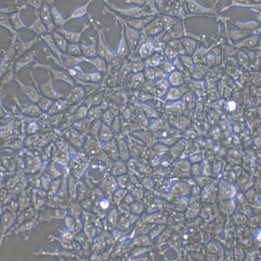 NCI-H1755 Cell:人肺癌細胞系,NCI-H1755 Cell