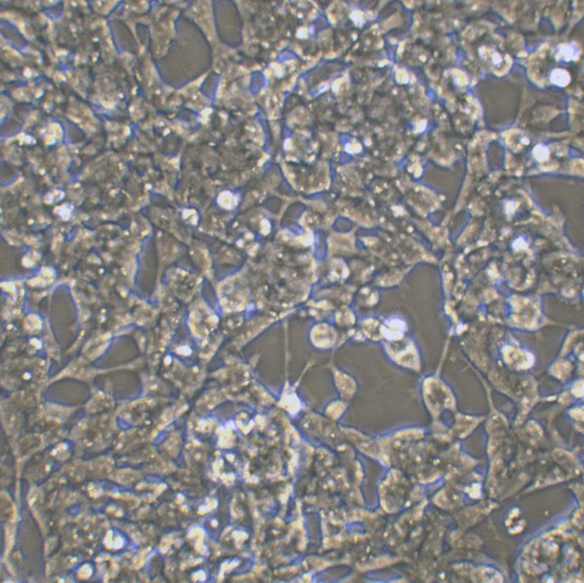 CI-H358 Cell:人非小细胞肺癌细胞系,CI-H358 Cell