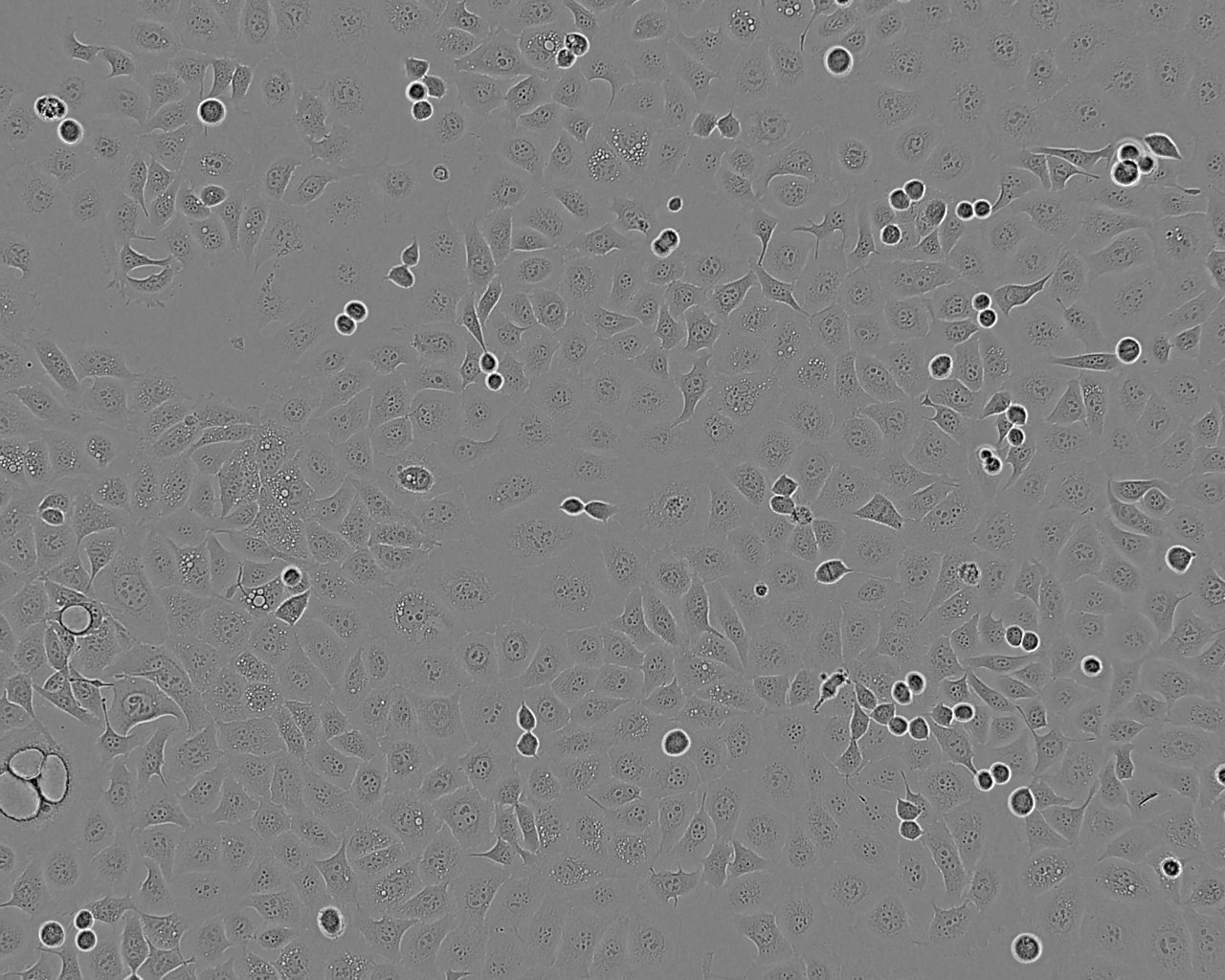 HCC827 Cell:人非小细胞肺癌细胞系,HCC827 Cell