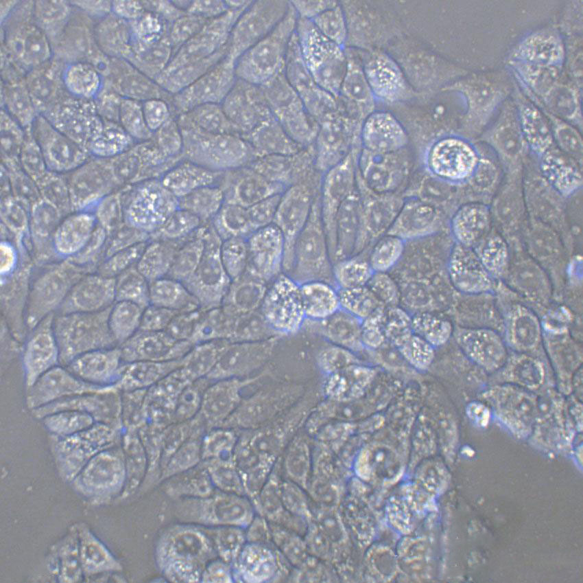 NCI-H460 Cell:人大细胞肺癌细胞系,NCI-H460 Cell