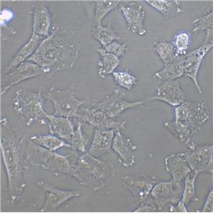 HCCC-9810 Cell:人胆管细胞型肝癌细胞系