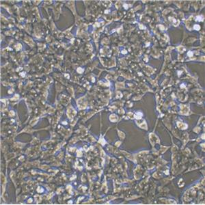 CI-H358 Cell:人非小细胞肺癌细胞系