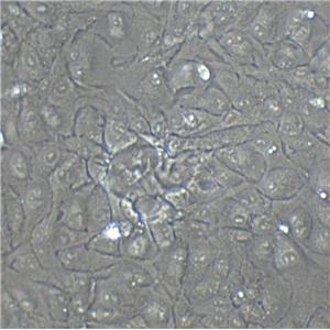 NCI-H1650 Cell:人非小细胞肺癌细胞系