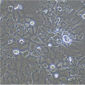 HuH-6 Cell:人肝母细胞瘤细胞系
