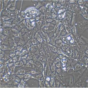 SNU-398 Cell:人肝癌细胞系