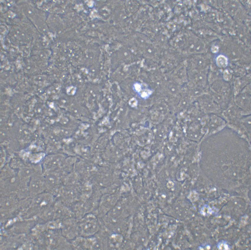 NCI-H441 Cell:人肺腺癌细胞系,NCI-H441 Cell