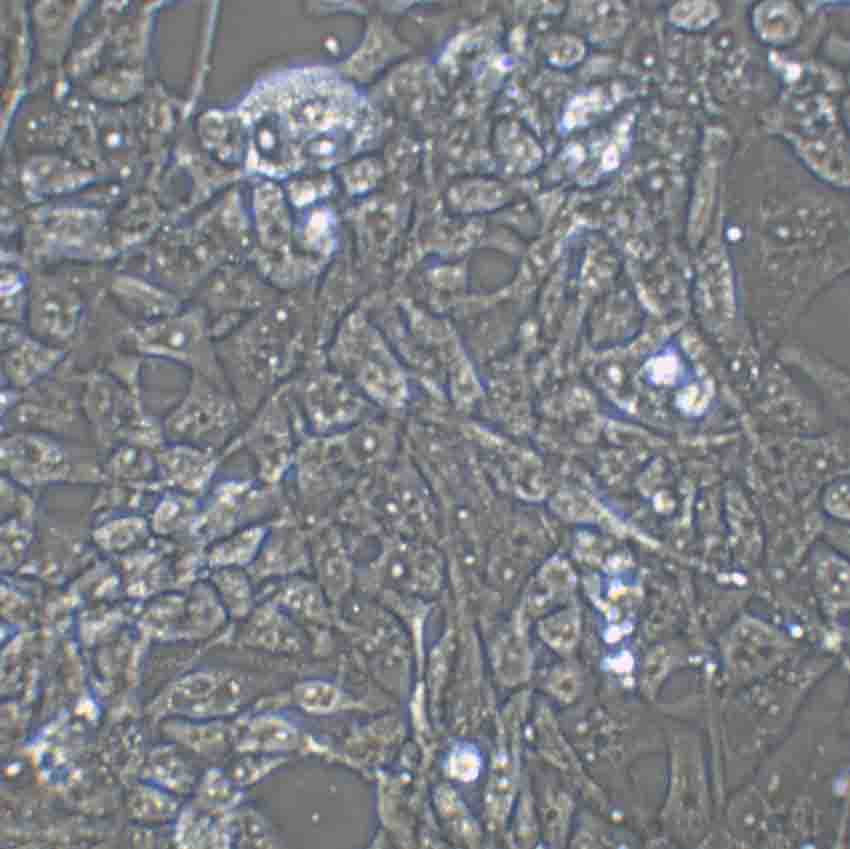 NCI-H292 Cell:人肺腺癌细胞系,NCI-H292 Cell