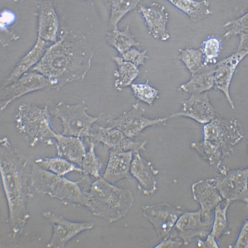 NCI-H1975 Cell:人肺腺癌细胞系,NCI-H1975 Cell