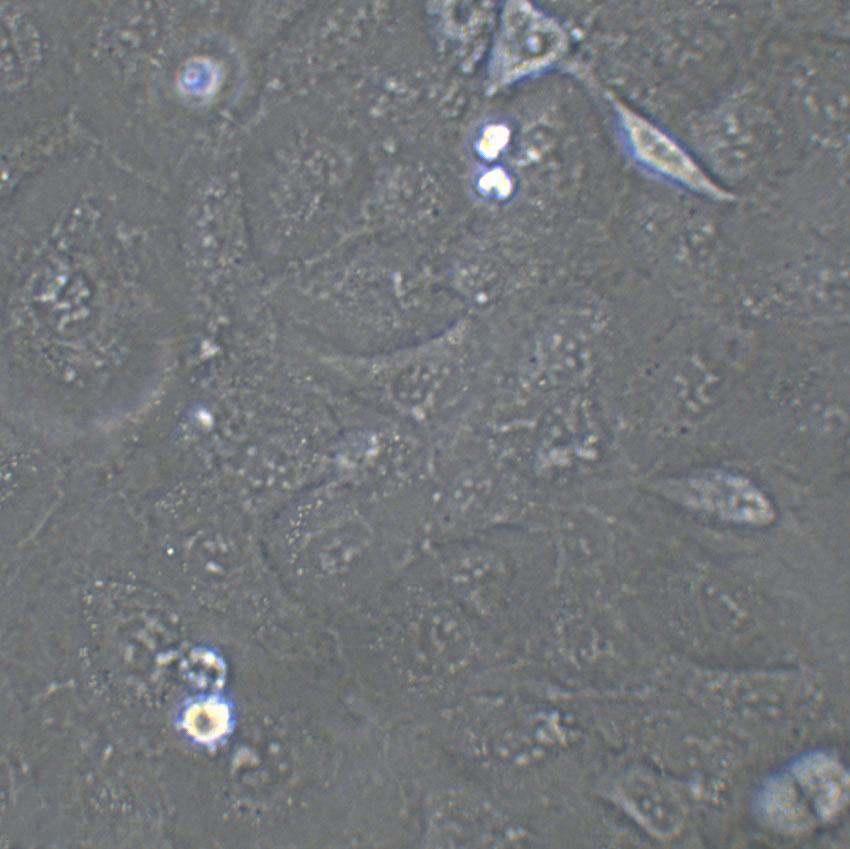 Calu-3 Cell:人肺腺癌细胞系,Calu-3 Cell