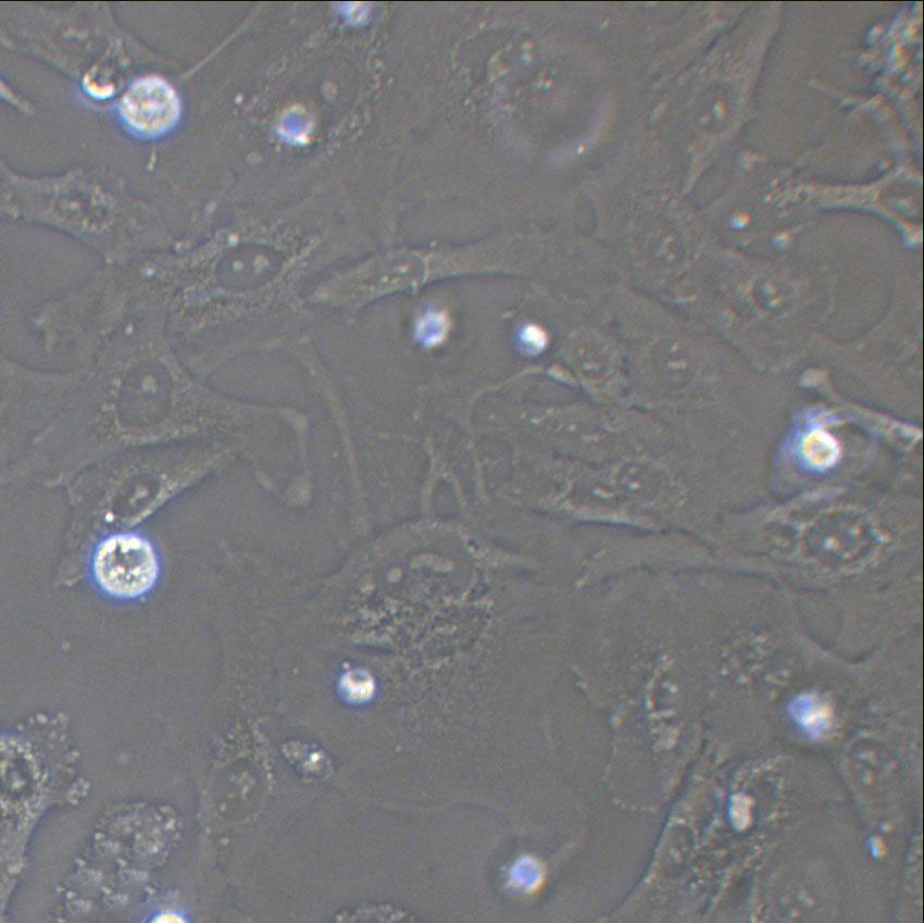 MHCC97-H Cell:高转移人肝癌细胞系,MHCC97-H Cell