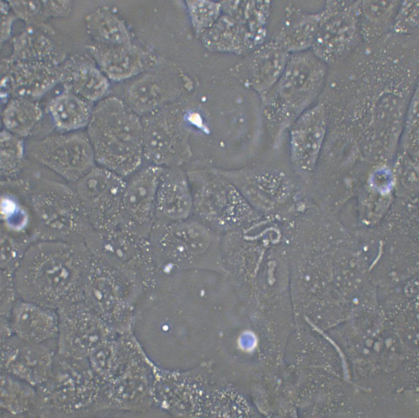 HEp-2 Cell:人喉表皮样癌细胞系,HEp-2 Cell