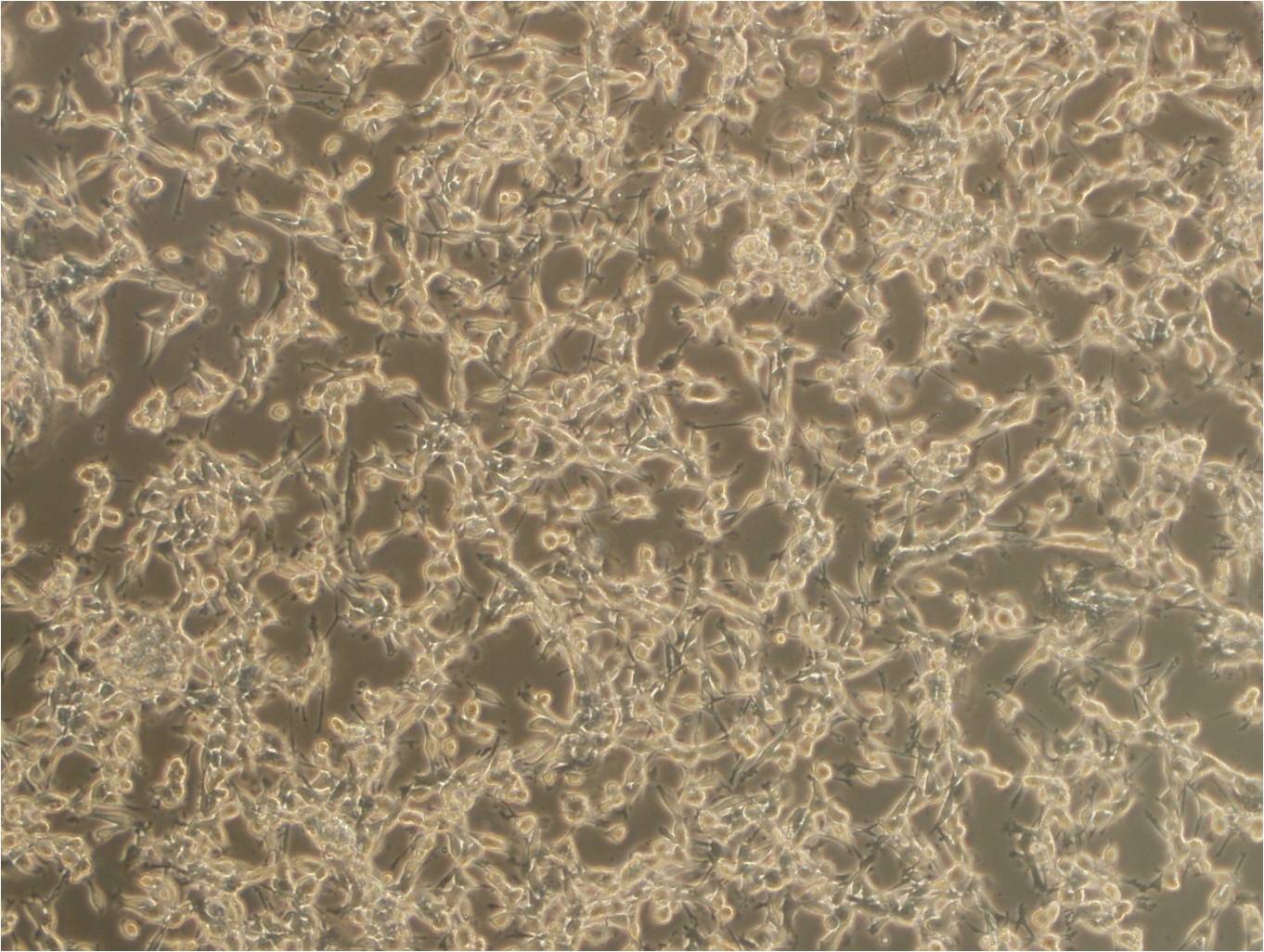 ACC-3 Cell:人涎腺腺样囊性癌细胞系,ACC-3 Cell