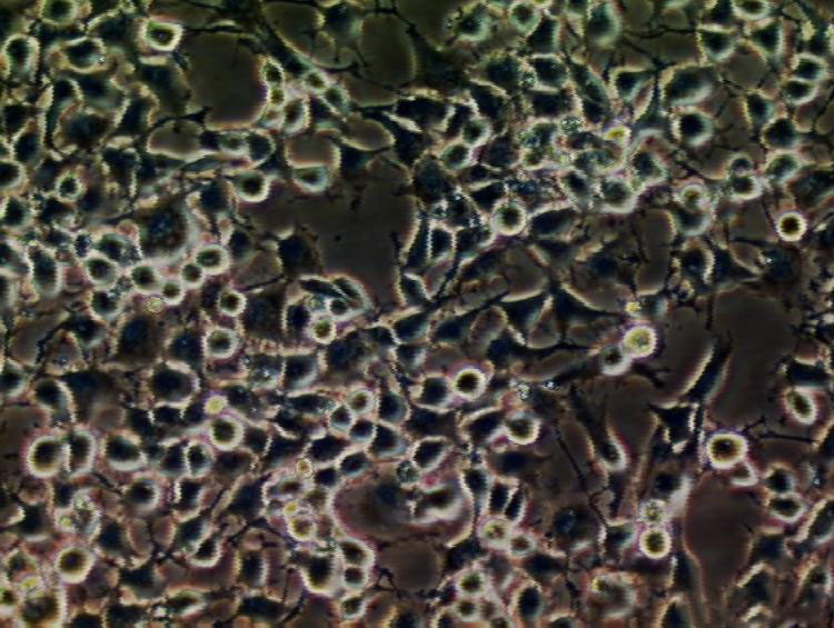 KB Cell:口腔表皮样癌细胞系,KB Cell