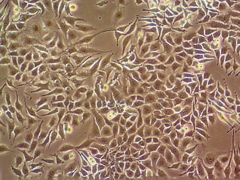 HTR-8 Cell:人滋養(yǎng)細(xì)胞系,HTR-8 Cell