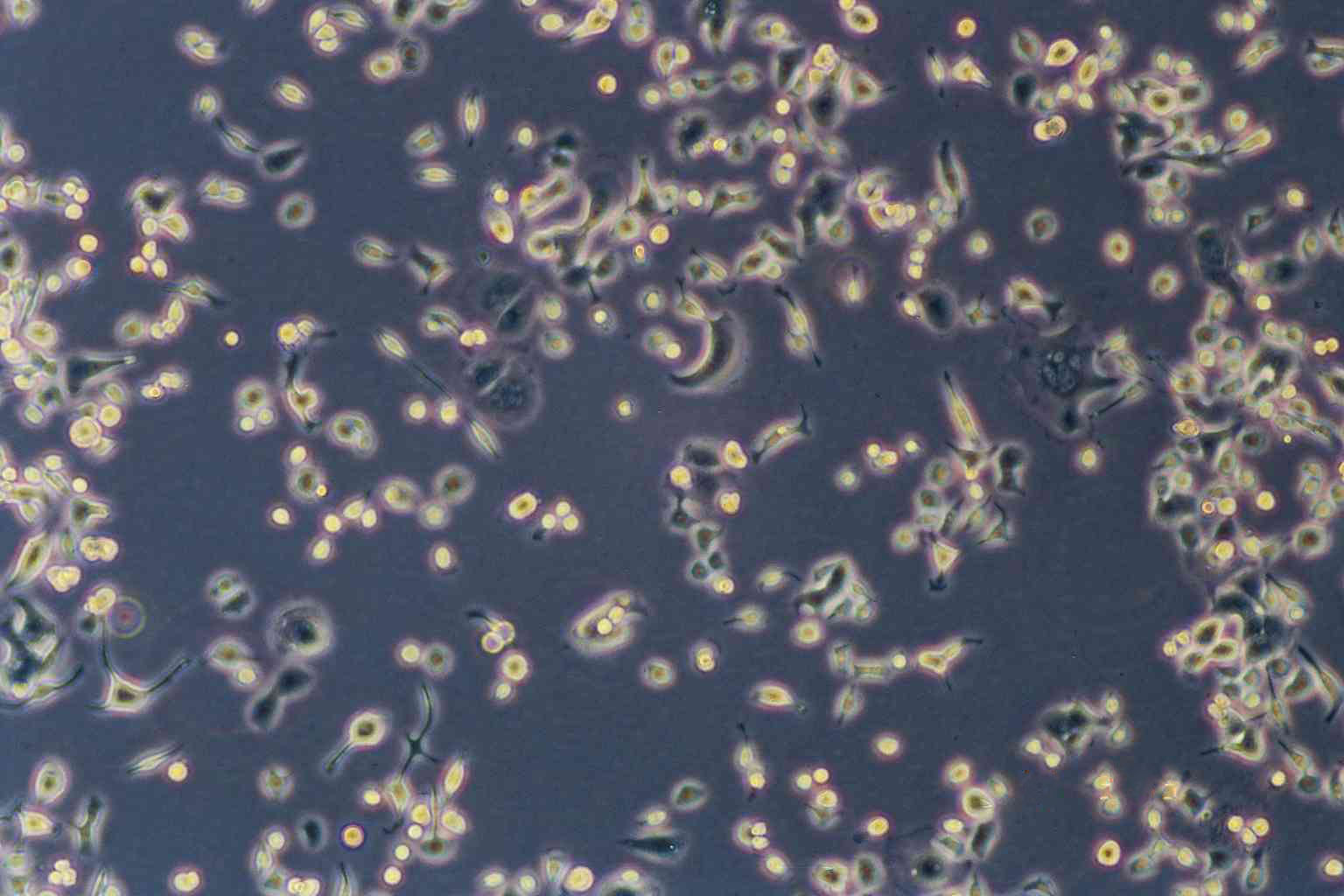 MDA-MB-415 Cell:人乳腺腺癌细胞系,MDA-MB-415 Cell