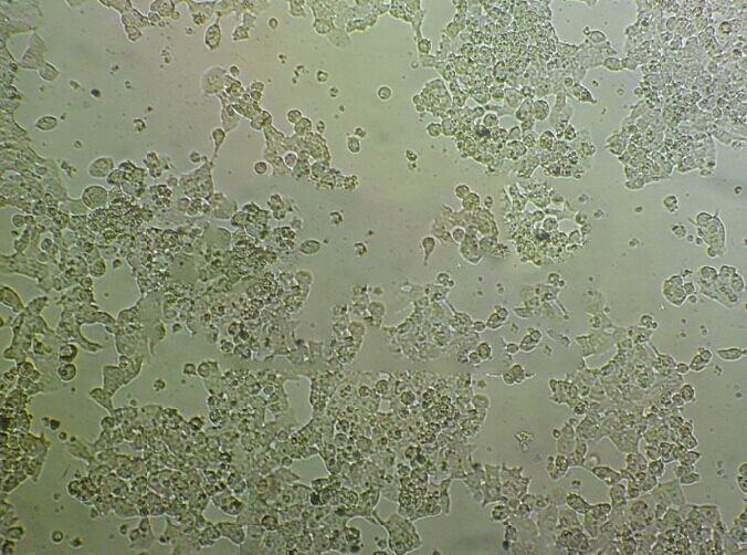 MDA-MB-468 Cell:人乳腺癌细胞系,MDA-MB-468 Cell
