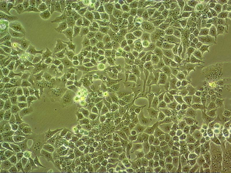 KYSE-450 Cell:人食管癌细胞系,KYSE-450 Cell