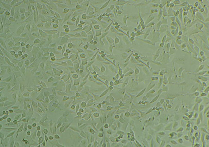 SCC-9 Cell:人类鳞状上皮舌癌细胞系,SCC-9 Cell