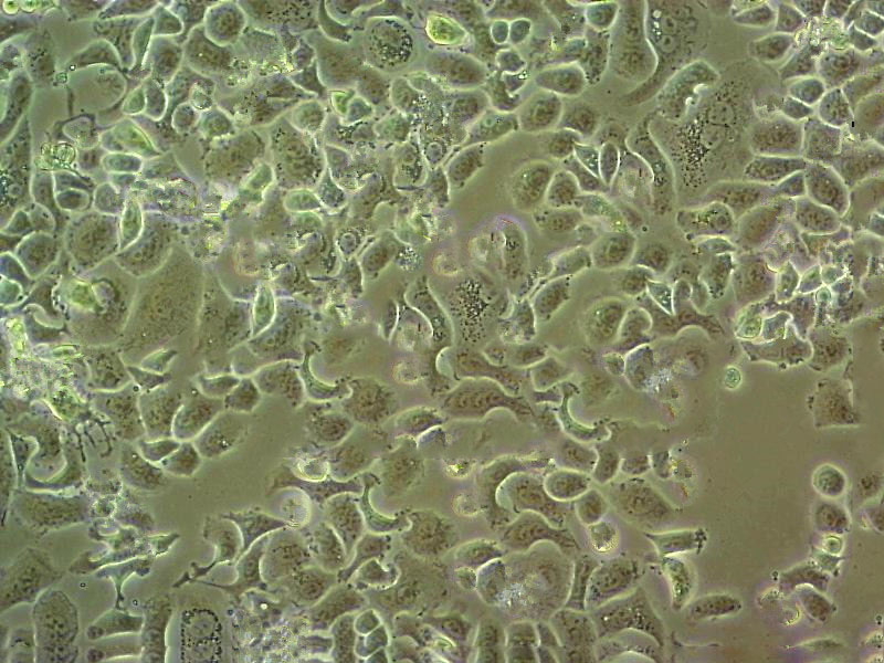 KP-N-NS Cell:人肾上腺神经母细胞瘤细胞系,KP-N-NS Cell