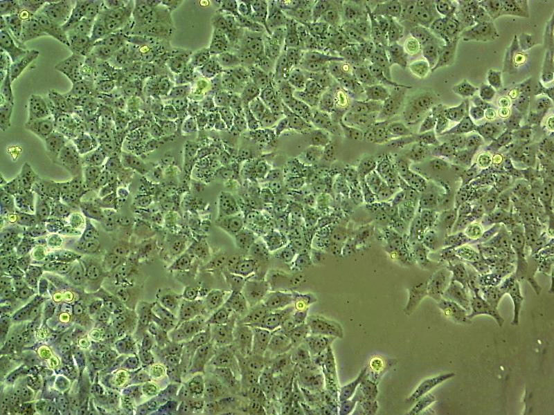 BeWo Cell:人胎盘绒膜癌细胞系,BeWo Cell