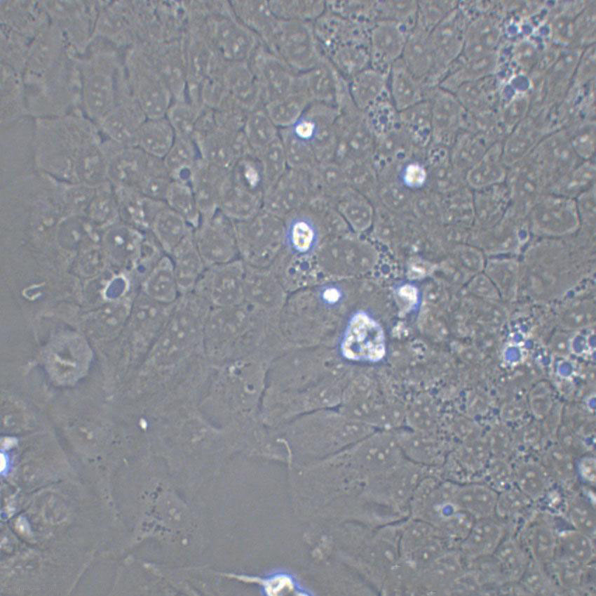 AN3-CA Cell:人子宫内膜腺癌细胞系,AN3-CA Cell