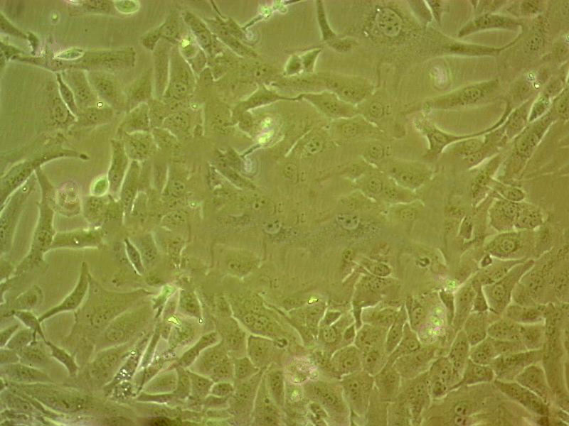 MS751 Cell:人子宫颈表皮癌细胞系,MS751 Cell