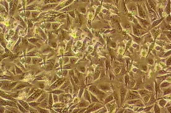 ME-180 Cell:人子宫颈表皮癌细胞系,ME-180 Cell