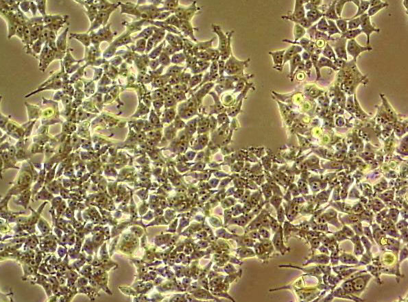 COLO 16 Cell:人皮肤鳞癌细胞系,COLO 16 Cell