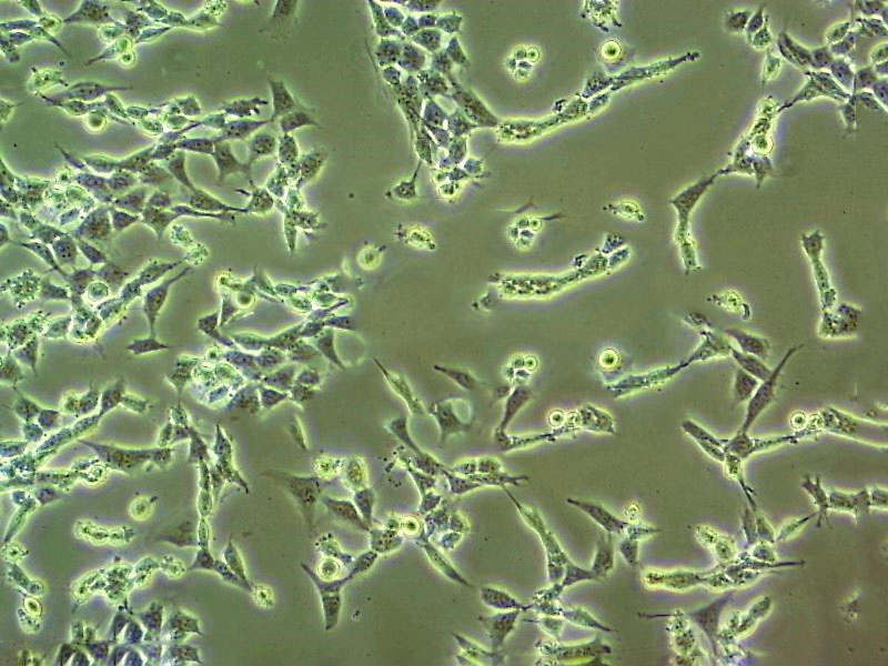 KLN205 Cell:小鼠肺鳞癌细胞系,KLN205 Cell