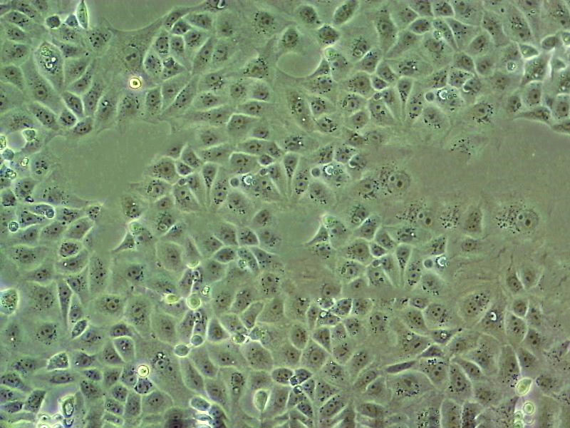 HB611 Cell:人肝母细胞癌细胞系,HB611 Cell