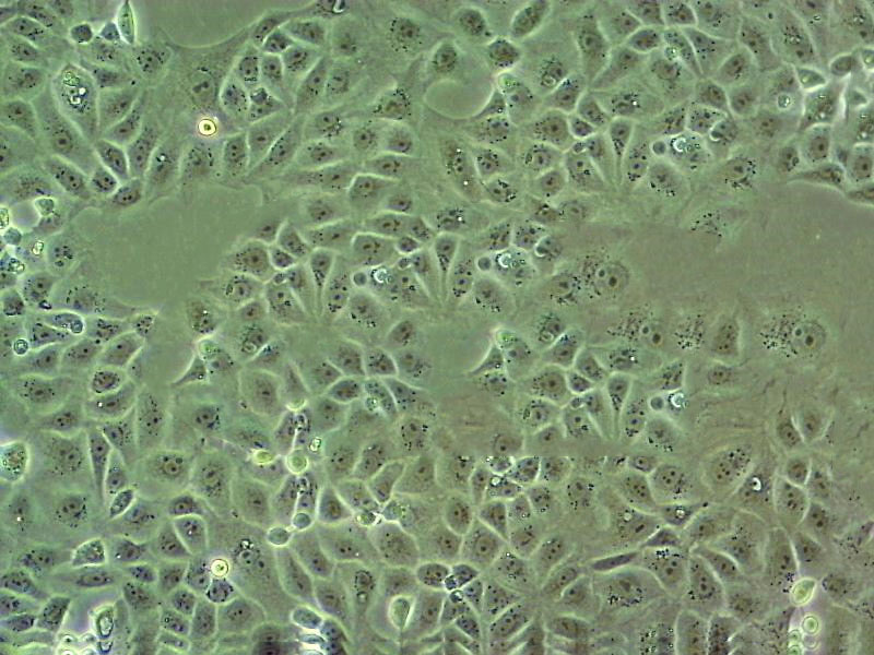 HB611 Cell:人肝母細胞癌細胞系,HB611 Cell