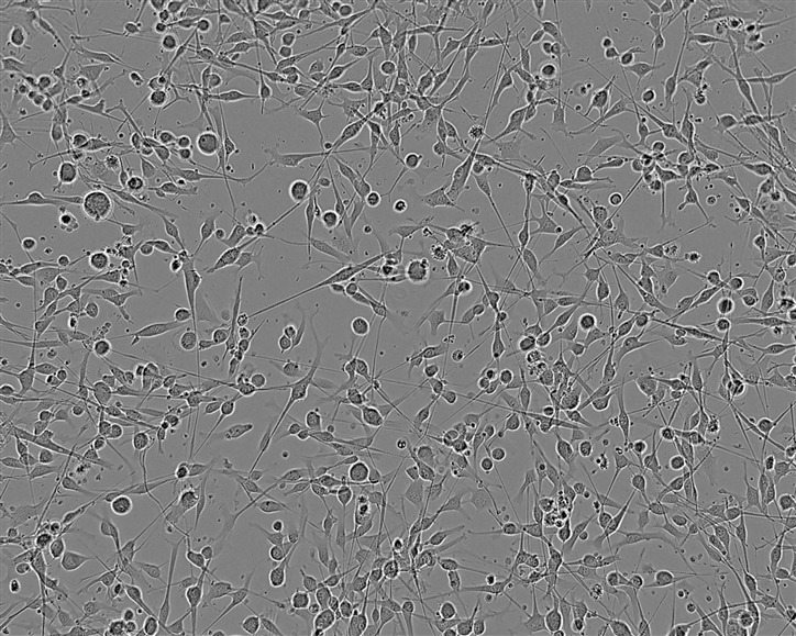 SHIN-3 Cell:人卵巢浆液性囊腺癌细胞系,SHIN-3 Cell