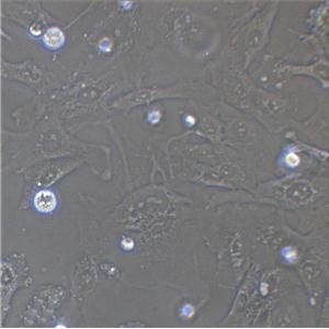 MHCC97-H Cell:高转移人肝癌细胞系