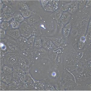HEp-2 Cell:人喉表皮样癌细胞系