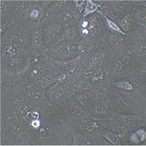 SW579 Cell:人甲状腺鳞癌细胞系