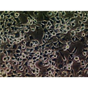 KB Cell:口腔表皮样癌细胞系