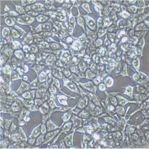 MDA-MB-453 Cell:人乳腺癌细胞系,MDA-MB-453 Cell