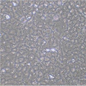 HBL-100 Cell:人整合SV40基因的乳腺上皮细胞系