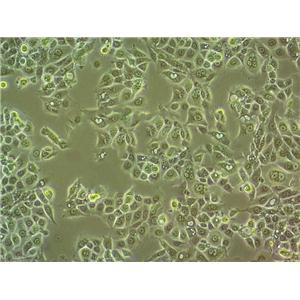 NCI-N87 Cell:人胃癌细胞系