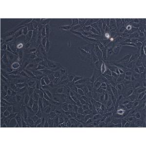 HMEC-1 Cell:人微血管内皮细胞系