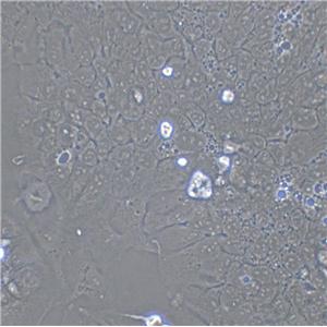 AN3-CA Cell:人子宫内膜腺癌细胞系