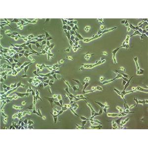 ETCC007 Cell:人乳腺导管癌细胞系,ETCC007 Cell
