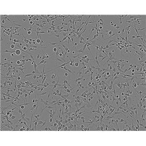 TR146 Cell:人食管鳞癌细胞系