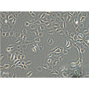 SCLC-21H Cell:人小细胞肺癌细胞系